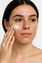 Carica l'immagine nel visualizzatore di Gallery, CREMA VISO PELLI ACNEICHE